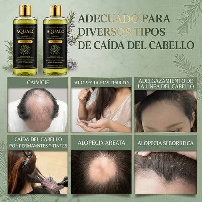 AQUALO™ Shampoo Anticaída y Crecimiento