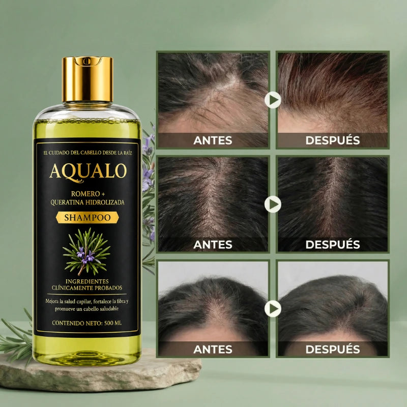 AQUALO™ Shampoo Anticaída y Crecimiento