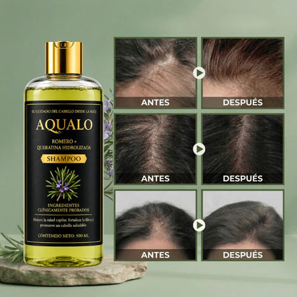 AQUALO™ Shampoo Anticaída y Crecimiento